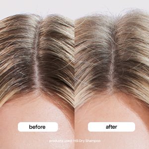 Alternative view of DRY SHAMPOO