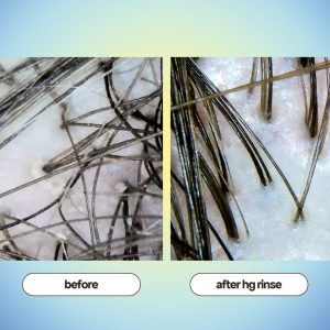 Alternative view of MINI CLARIFYING SCALP & HAIR RINSE